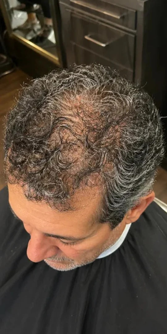 Antes